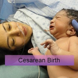 A mother in an operating gown is led back being shown her baby - cesarean research and guidelines